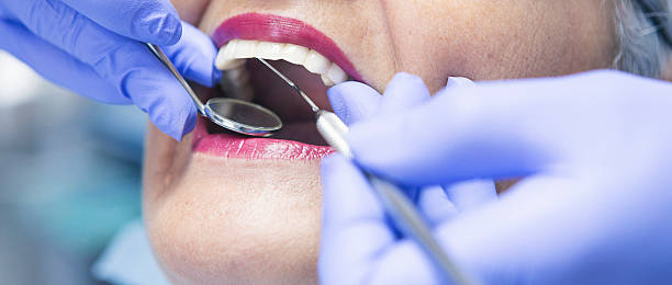Best Chipped Tooth Repair Near Me  in East Hemet, CA